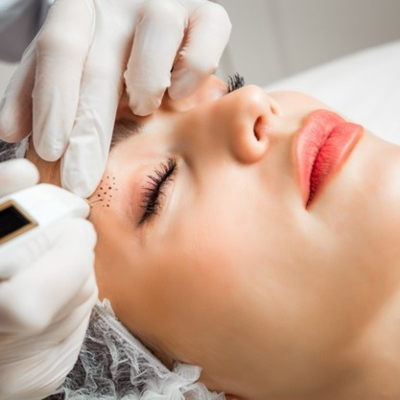 Jato de Plasma  Eletrocautério terapêutico 